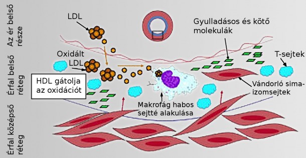 Koleszterin szállítás az érben