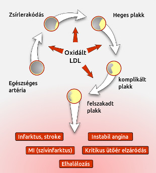az oxidált LDL hatása az érelzáródás kialakulására